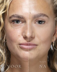 Links zonder make-up, rechts met Loose Setting Powder in de tint Roos