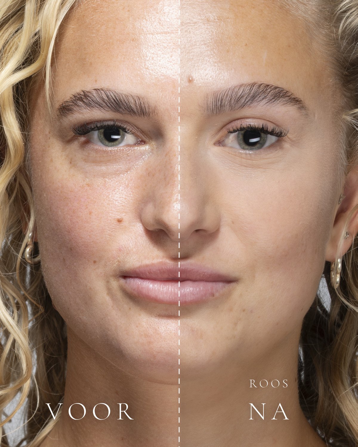 Links zonder make-up, rechts met Loose Setting Powder in de tint Roos