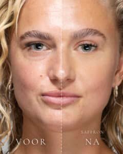 Links zonder make-up, rechts met Loose Setting Powder in de tint Saffron