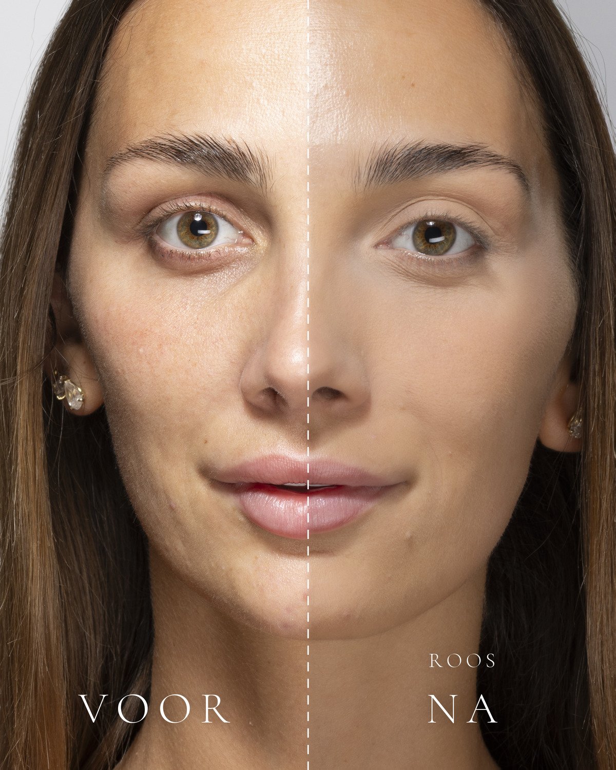 Links het gezicht zonder make-up, rechts met Loose Setting Powder in de tint Roos